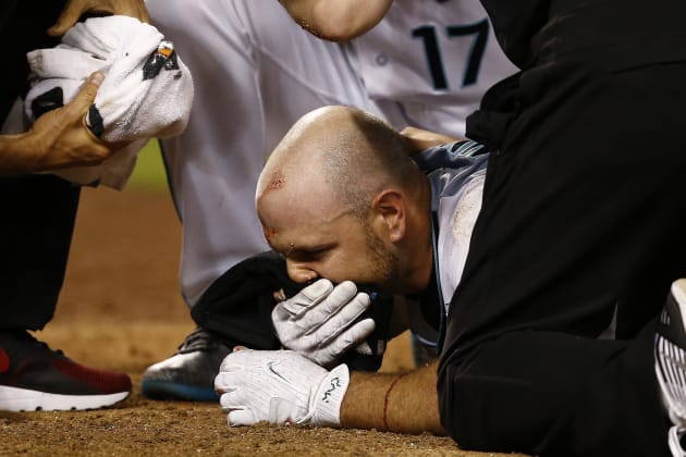 D-Backs' Chris Iannetta hit in face by pitch