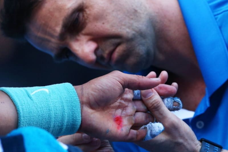 Rafael Nadal S Blistered Hand At Australian Open Match Looks Painful Bleacher Report Latest News Videos And Highlights