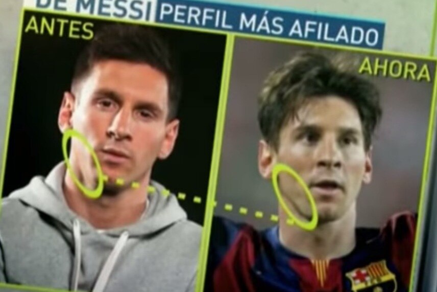 Spanish Television Break Down The Transformation Of Leaner Lionel Messi S Face Bleacher Report Latest News Videos And Highlights