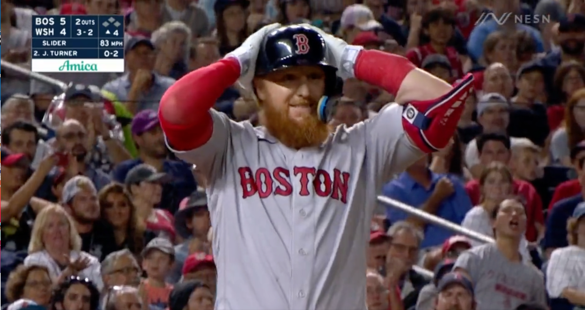 Red Sox 3B Justin Turner Shares Gruesome Photo Of Face After Getting Hit By  A Pitch
