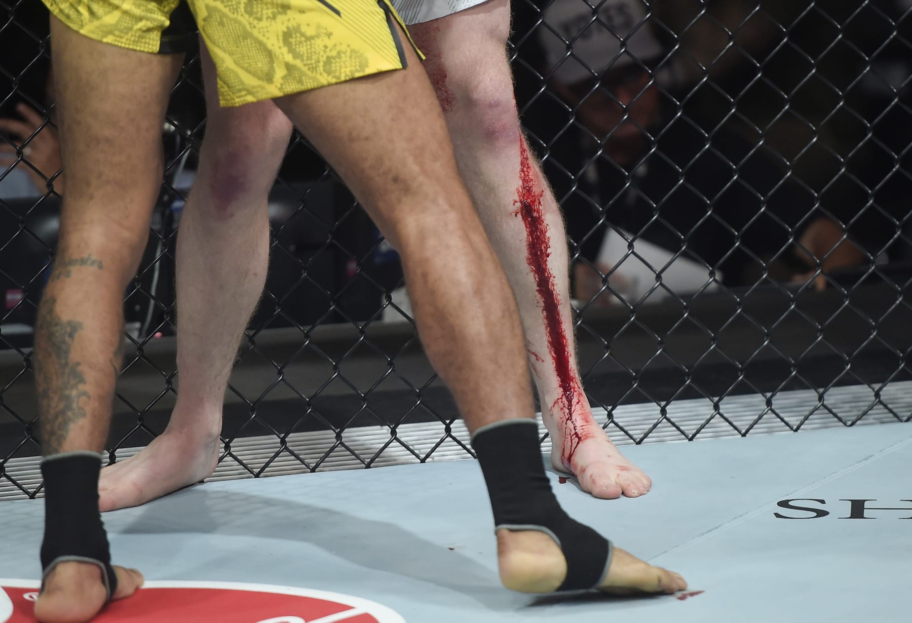 RIO DE JANEIRO, BRAZIL - MAY 04: A view of a cut on the shin of Jack Shore of Wales as he battles Joanderson Brito of Brazil in a featherweight bout during the UFC 301 event at Farmasi Arena on May 04, 2024 in Rio de Janeiro, Brazil. (Photo by Alexandre Loureiro/Zuffa LLC via Getty Images)