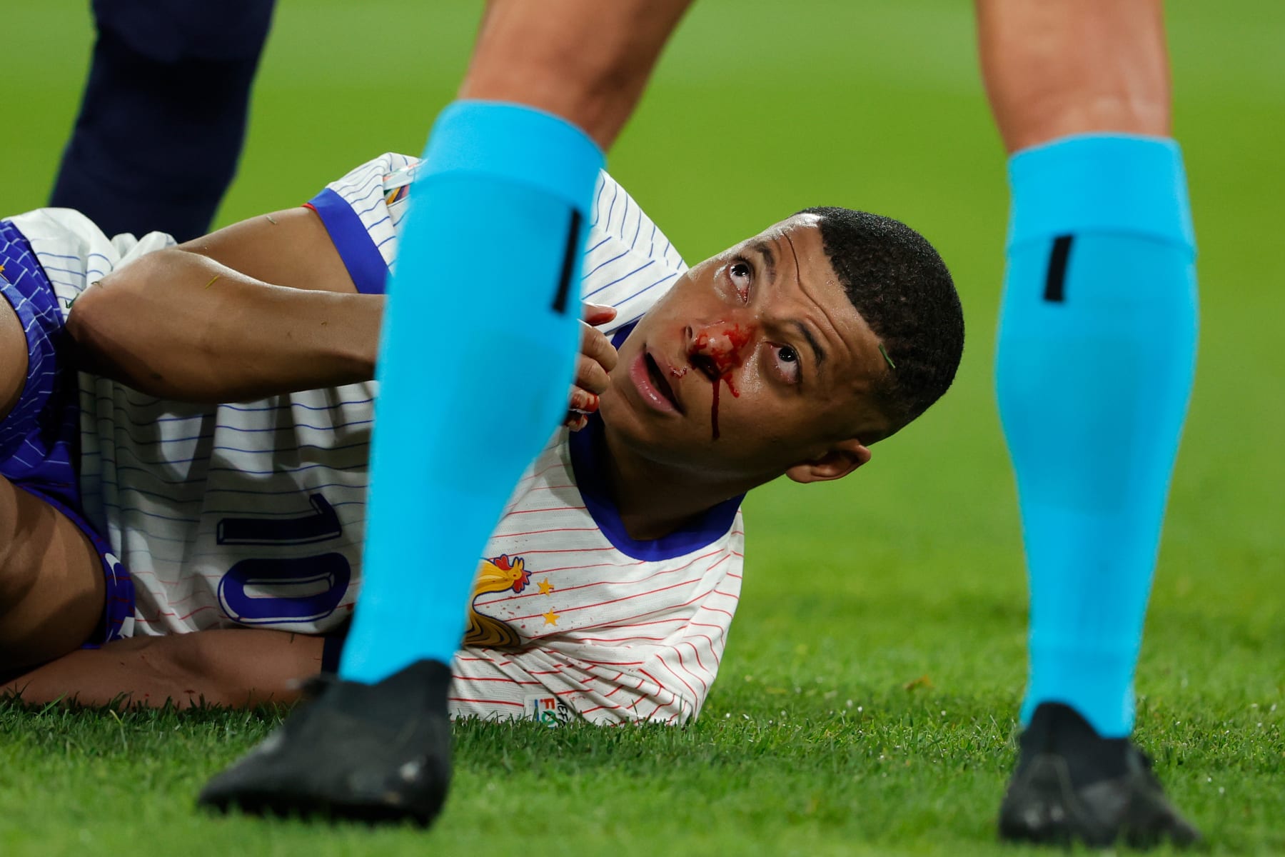 DUSSELDORF, GERMANY - JUNE 17: Kylian Mbappe of France Injured his head during the EURO match between Austria v France at the Merkur Spiel Arena on June 17, 2024 in Dusseldorf Germany (Photo by Rico Brouwer/Soccrates/Getty Images)