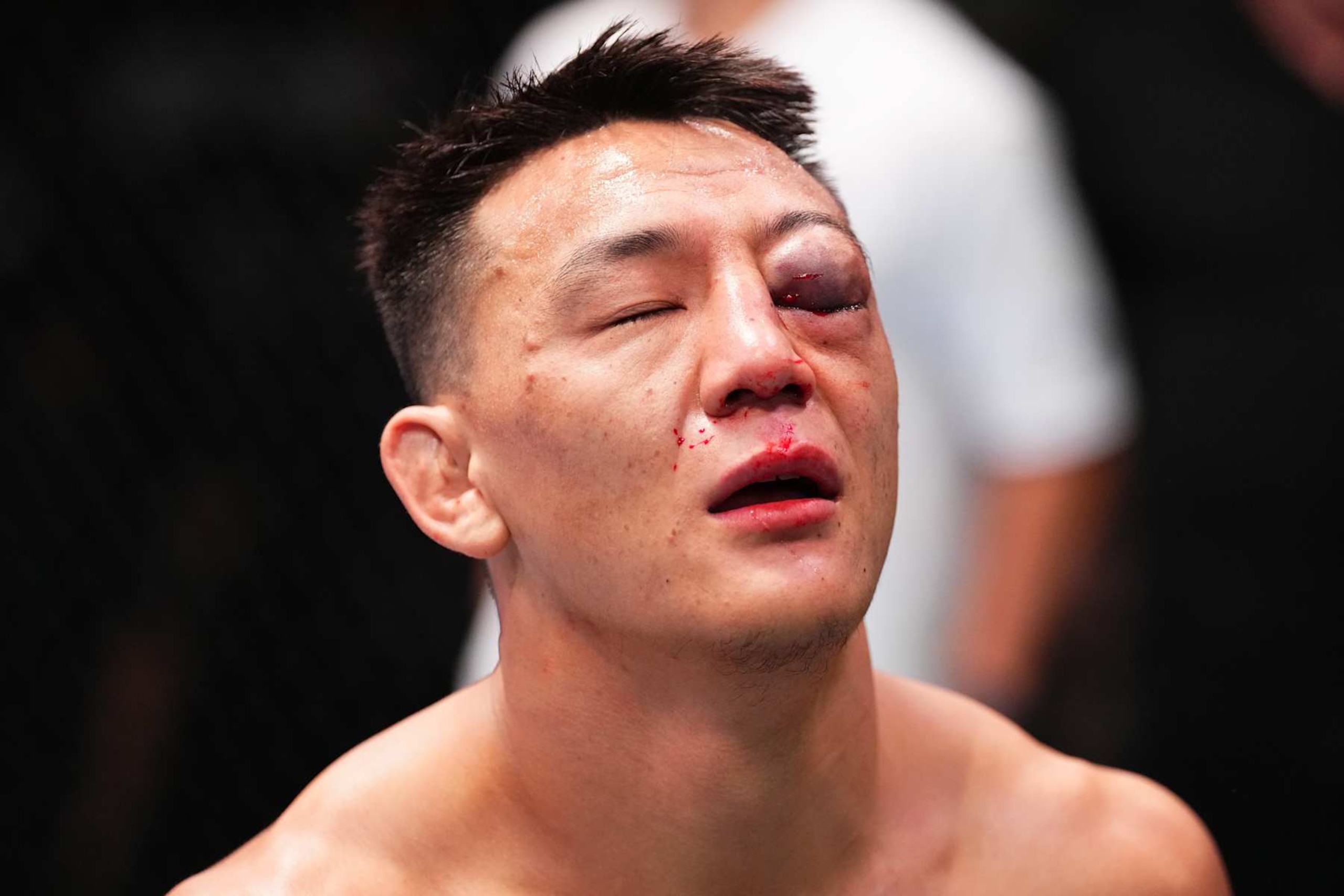 LAS VEGAS, NEVADA - SEPTEMBER 07: A detail view of the swollen eye of Rongzhu of China after receiving an elbow from Chris Padilla in a lightweight fight during the UFC Fight Night event at UFC APEX on September 07, 2024 in Las Vegas, Nevada. (Photo by Chris Unger/Zuffa LLC via Getty Images)
