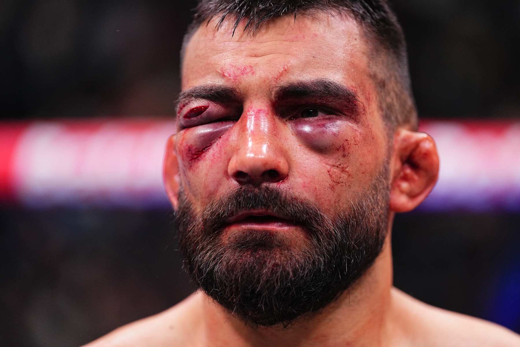 PARIS, FRANCE - SEPTEMBER 28: Benoit Saint Denis of France reacts after a TKO loss against Renato Moicano of Brazil in a lightweight fight during the UFC Fight Night event at The Accor Arena on September 28, 2024 in Paris, France. (Photo by Chris Unger/Zuffa LLC)