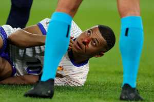 France's Kylian Mbappé Avoids Surgery For Broken Nose Injury vs. Austria; Status TBD