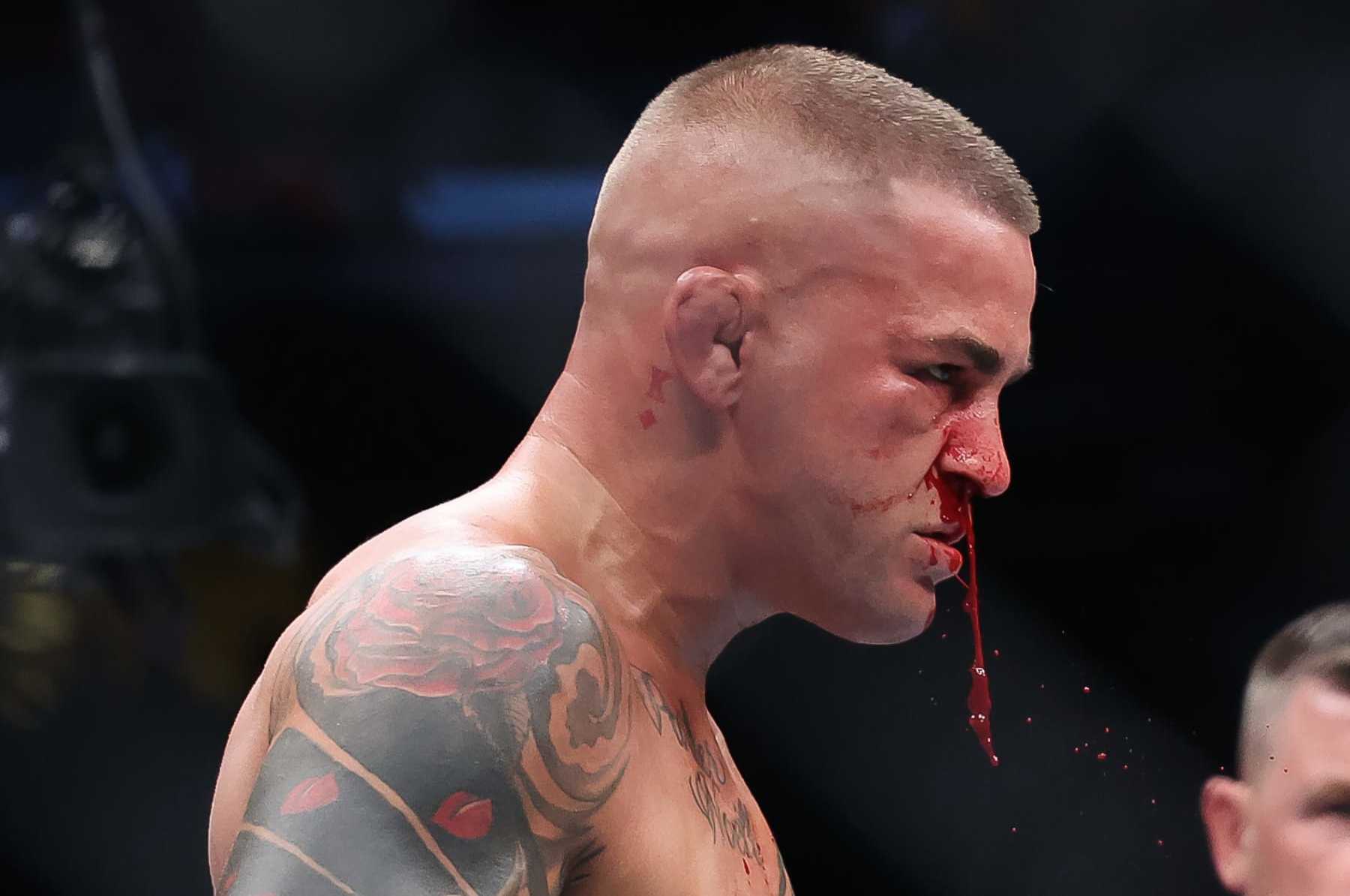 Dustin Poirier drips blood in his fight with Islam Makhachev