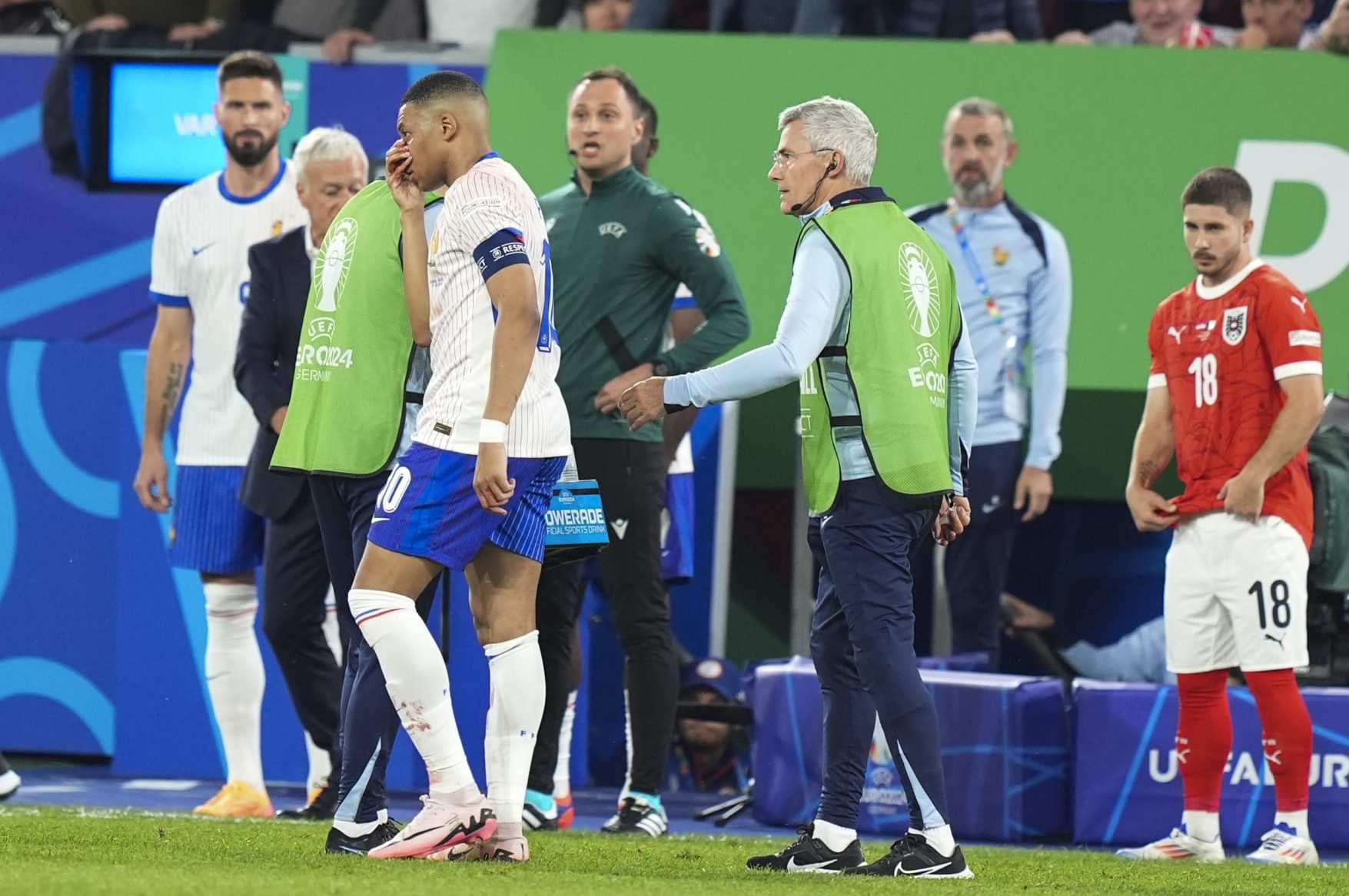 DUSSELDORF, GERMANY - JUNE 17: Kylian Mbappe (10) of France bleed from the nose during the 2024 European Football Championship (EURO 2024) Group D football match between France and Austria at Merkur Spiel-Arena in Dusseldorf, Germany on June 17, 2024. (Photo by Emin Sansar/Anadolu via Getty Images)