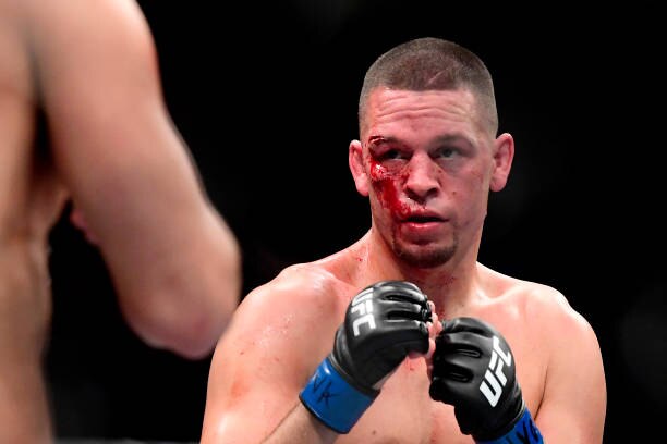 Report Nate Diaz Vs Leon Edwards Fight Rescheduled For Ufc 263 Due To Diaz Injury Bleacher Report Latest News Videos And Highlights