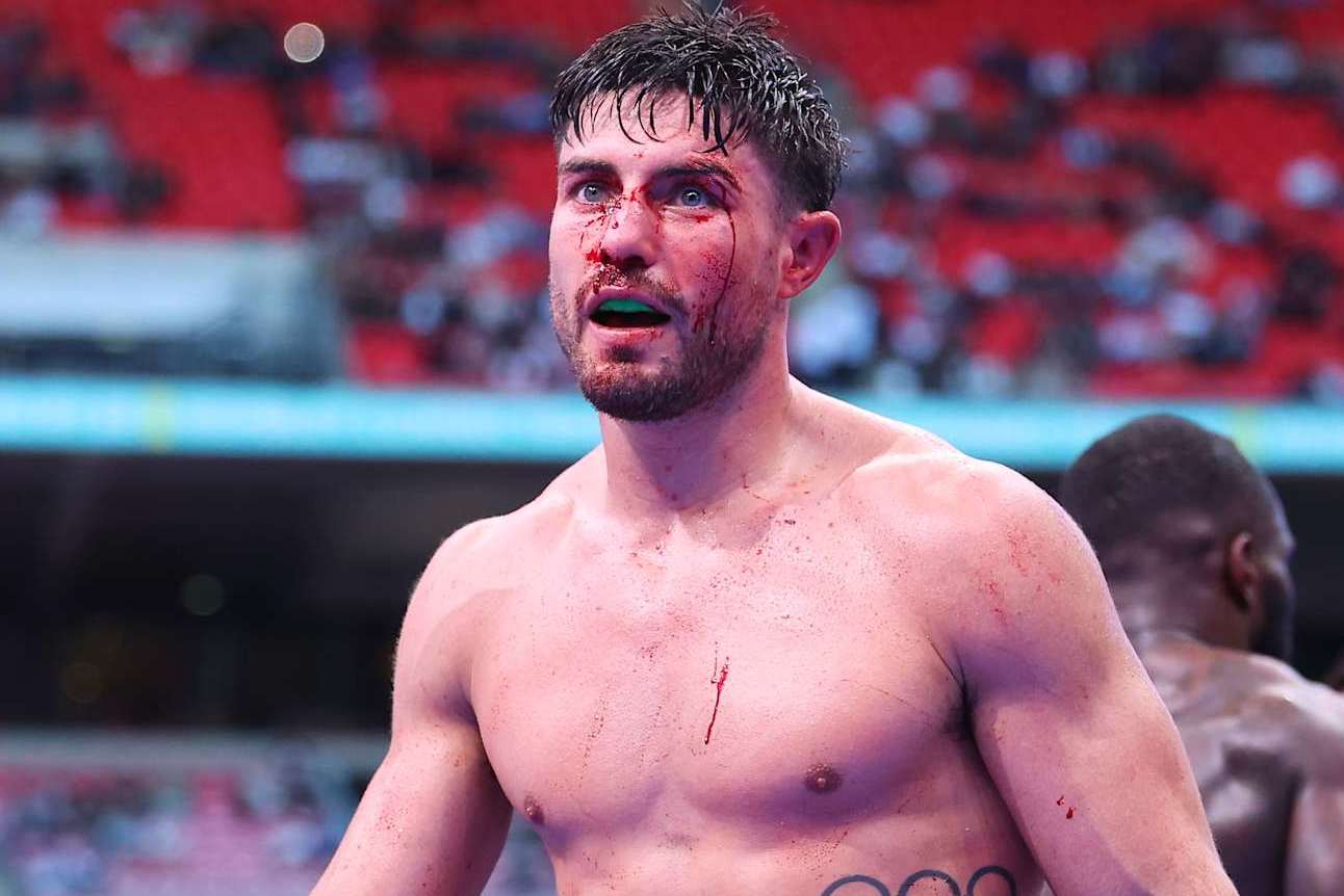 LONDON, ENGLAND - SEPTEMBER 21: Josh Kelly looks on with blood running from a cut during the Middleweight fight between Josh Kelly and Ishmael Davis, on the Riyadh Season - Wembley Edition card at Wembley Stadium on September 21, 2024 in London, England. (Photo by Richard Pelham/Getty Images)