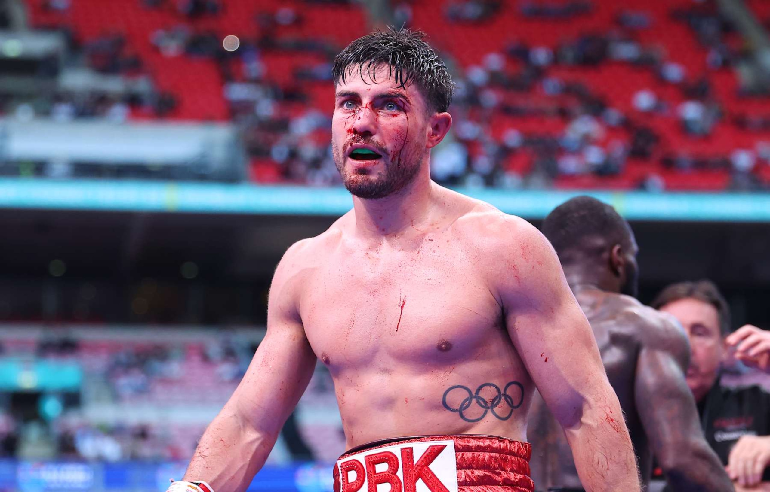 LONDON, ENGLAND - SEPTEMBER 21: Josh Kelly looks on with blood running from a cut during the Middleweight fight between Josh Kelly and Ishmael Davis, on the Riyadh Season  - Wembley Edition card at Wembley Stadium on September 21, 2024 in London, England. (Photo by Richard Pelham/Getty Images)