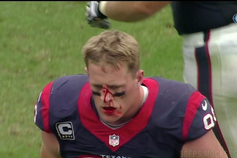 Of course J.J. Watt's upcoming Funko has a bloody nose  / Blowout Buzz