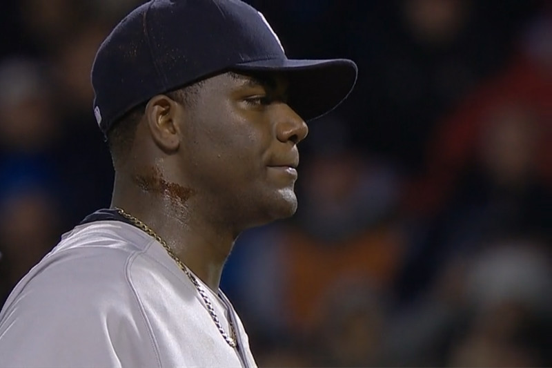 Pine Tar